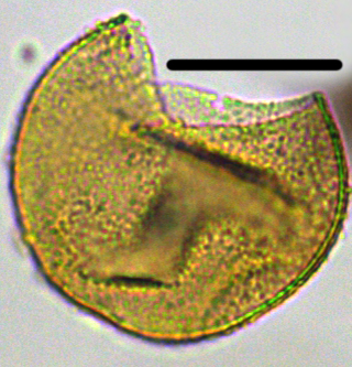 Pyxidinopsis iakovlevae Xensp27X3110112160945b.jpg